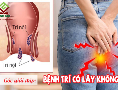 Bệnh trĩ có lây không, nguy hiểm gây ảnh hưởng sinh sản, tái phát không?