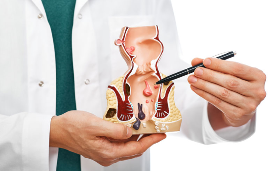Trĩ Nội Và Trĩ Ngoại: Phân Biệt Thế Nào?